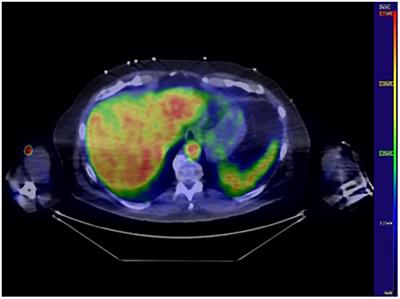 Daily standing time, dietary fiber, and intake of unsaturated fatty acids are beneficially associated with hepatic insulin sensitivity in adults with metabolic syndrome